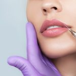 Enhancing Beauty Elegance: The Pervasiveness of Injectable Dermal Fillers in Lip Augmentation